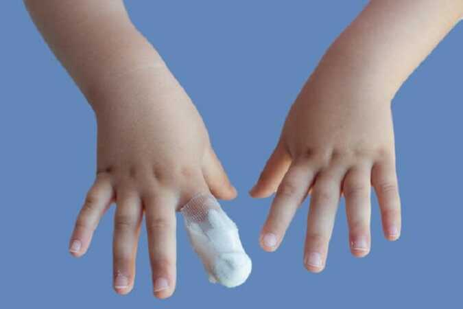 Двухлетний малыш скатился с детской горки в Кстово и лишился фаланги пальца на левой руке