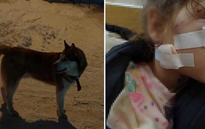 В Томске собака искусала лицо семилетней девочке