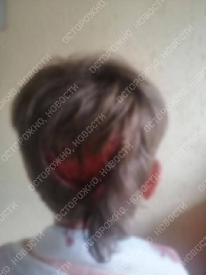В Саратове собака депутата «Единой России» напала на 6-летнего ребёнка queiqxeihuiquqkrt