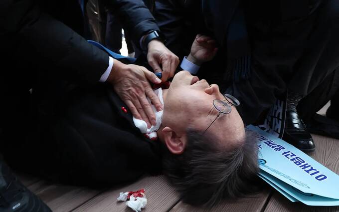 Экс-кандидата в президенты Южной Кореи ранили в шею ножом во время общения с прессой в Пусане xdideeieuiktkrt